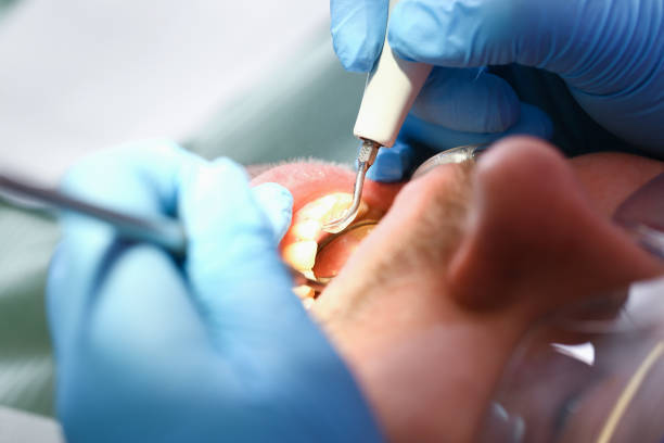 Best Emergency Denture Repair in Spencerville, OH